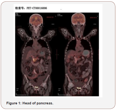 Click here to view Large Figure 1 irispublishers-openaccess-complementary-alternative-medicine