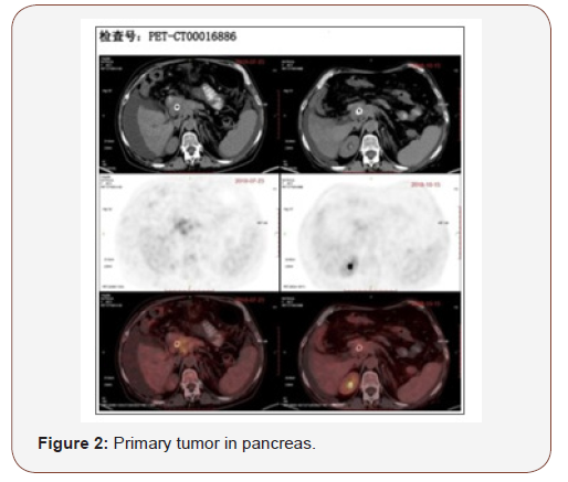 Click here to view Large Figure 2 irispublishers-openaccess-complementary-alternative-medicine