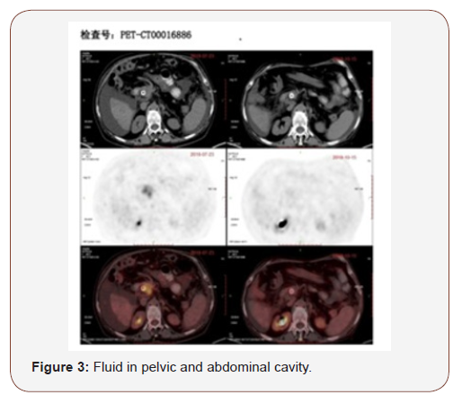 Click here to view Large Figure 3 irispublishers-openaccess-complementary-alternative-medicine