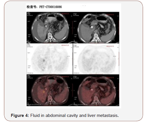 Click here to view Large Figure 4 irispublishers-openaccess-complementary-alternative-medicine