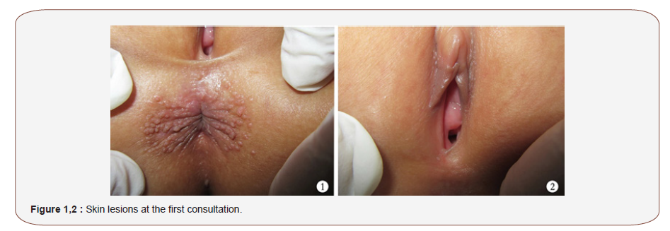 Click here to view Large Figure 1 irispublishers-openaccess-complementary-alternative-medicine