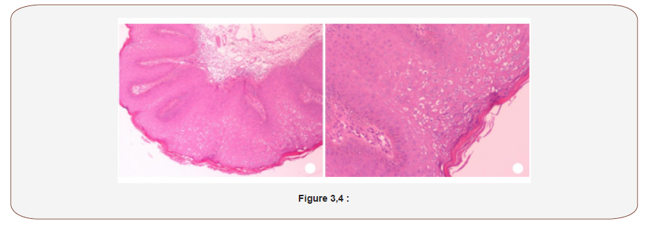 Click here to view Large Figure 2 irispublishers-openaccess-complementary-alternative-medicine