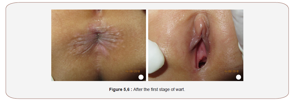 Click here to view Large Figure 3 irispublishers-openaccess-complementary-alternative-medicine