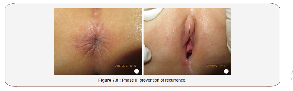 Click here to view Large Figure 4 irispublishers-openaccess-complementary-alternative-medicine