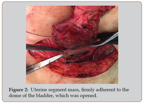 Click here to view Large Figure 2 irispublishers-openaccess-gynecology-womens-health
