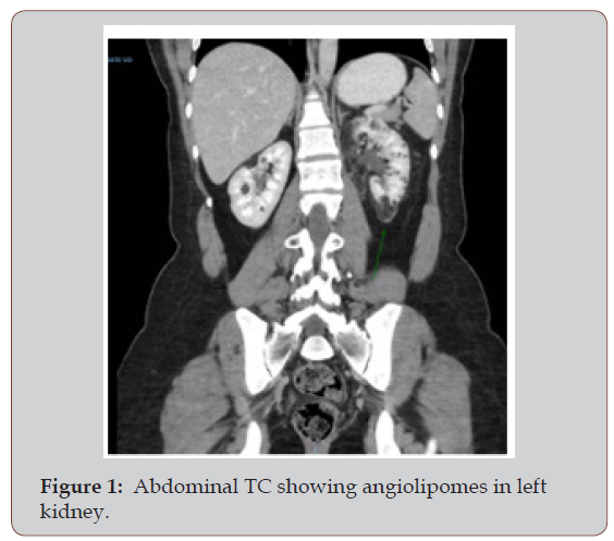 Click here to view Large Figure 1 irispublishers-openaccess-gynecology-womens-health