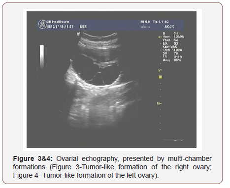 Click here to view Large Figure 3 irispublishers-openaccess-gynecology-womens-health