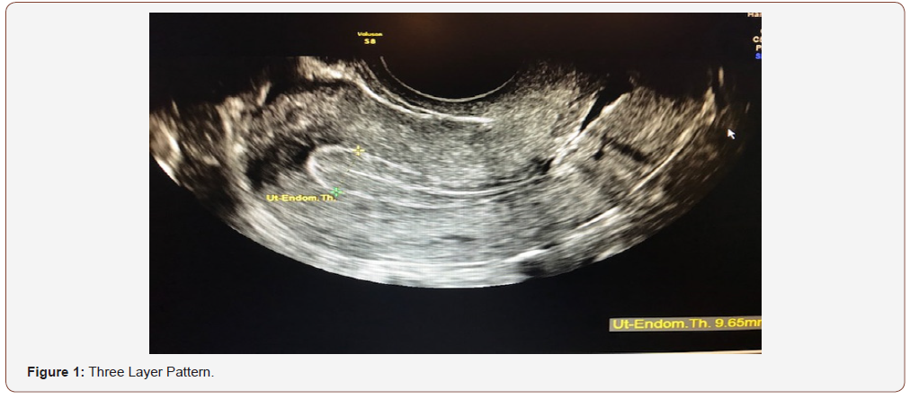 Click here to view Large Figure 1 irispublishers-openaccess-gynecology-womens-health