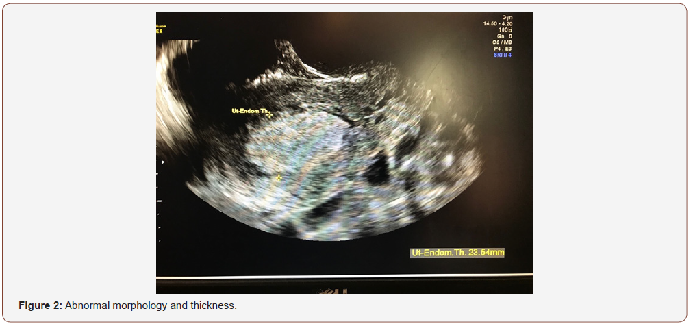 Click here to view Large Figure 2 irispublishers-openaccess-gynecology-womens-health