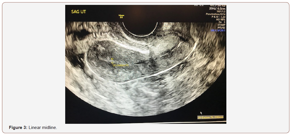 Click here to view Large Figure 3 irispublishers-openaccess-gynecology-womens-health