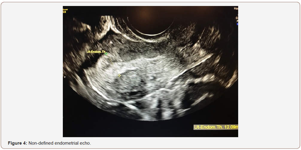 Click here to view Large Figure 4 irispublishers-openaccess-gynecology-womens-health