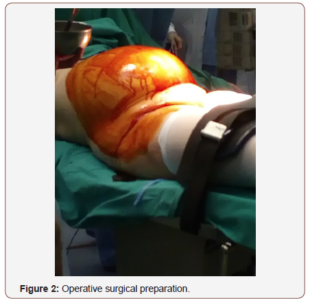 Click here to view Large Figure 2 irispublishers-openaccess-gynecology-womens-health