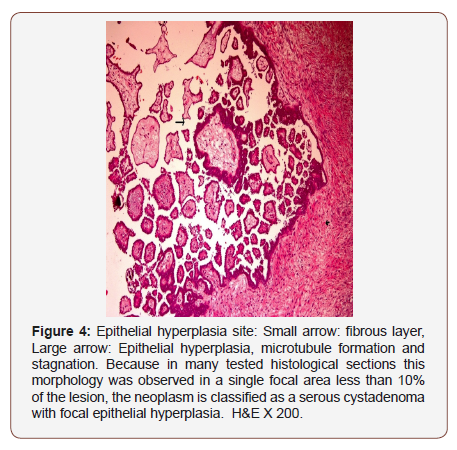 Click here to view Large Figure 4 irispublishers-openaccess-gynecology-womens-health