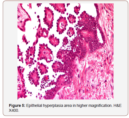 Click here to view Large Figure 5 irispublishers-openaccess-gynecology-womens-health