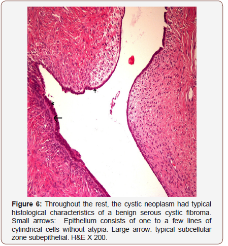 Click here to view Large Figure 6 irispublishers-openaccess-gynecology-womens-health