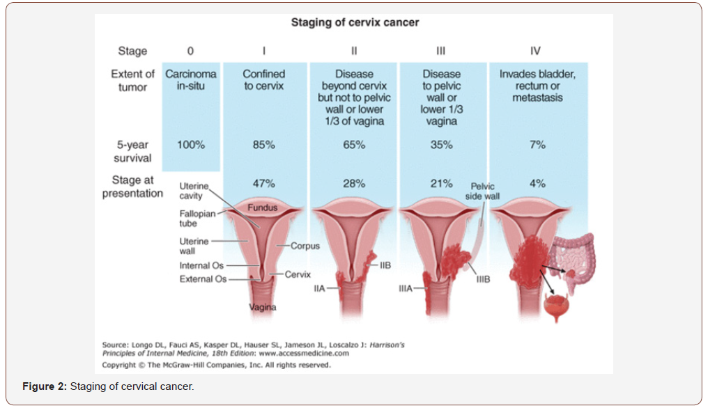 Click here to view Large Figure 2 irispublishers-openaccess-gynecology-womens-health