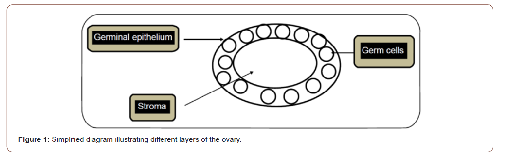 Click here to view Large Figure 1 irispublishers-openaccess-gynecology-womens-health