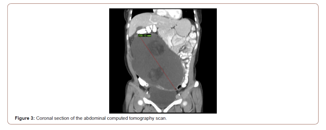 Click here to view Large Figure 3 irispublishers-openaccess-gynecology-womens-health
