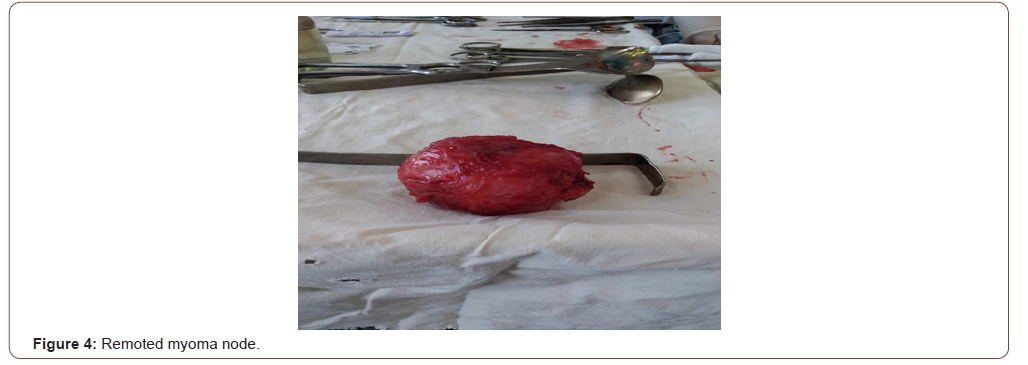 Click here to view Large Figure 4 irispublishers-openaccess-gynecology-womens-health