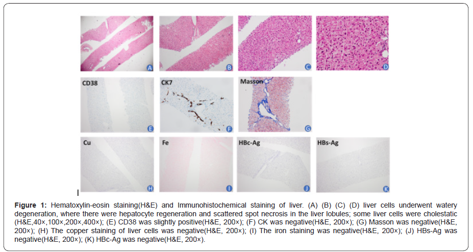 Click here to view Large Figure 1 irispublishers-openaccess-gynecology-womens-health