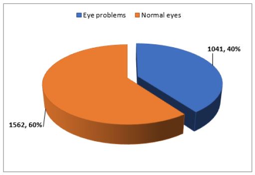 Click here to view Large Figure 2 irispublishers-openaccess-ophthalmology-vision-research