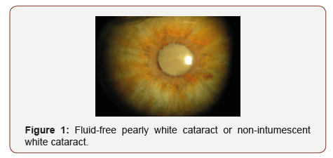 Click here to view Large Figure 1 irispublishers-openaccess-ophthalmology-vision-research